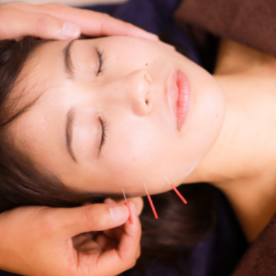 Cosmetic Facial Acupuncture: More Than Skin Deep
