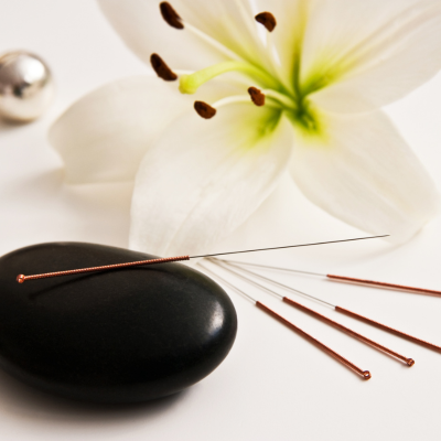 The Biophysics of Acupuncture for Infertility & IVF Success